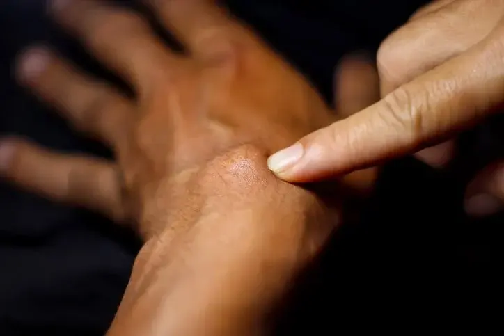 Cyst examination