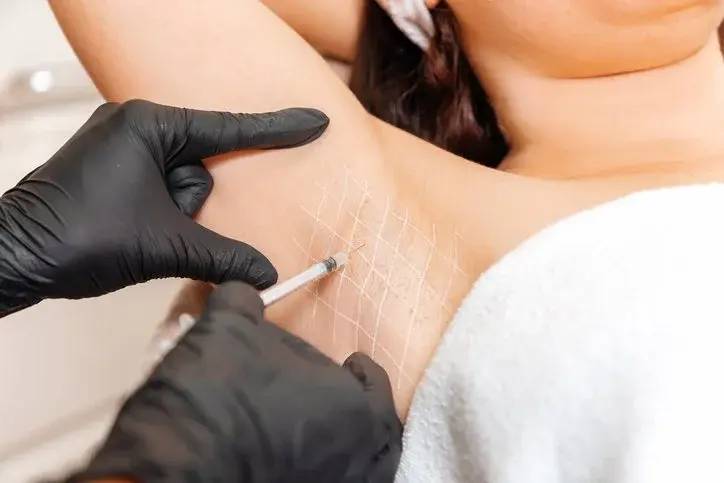 Hyperhidrosis treatment