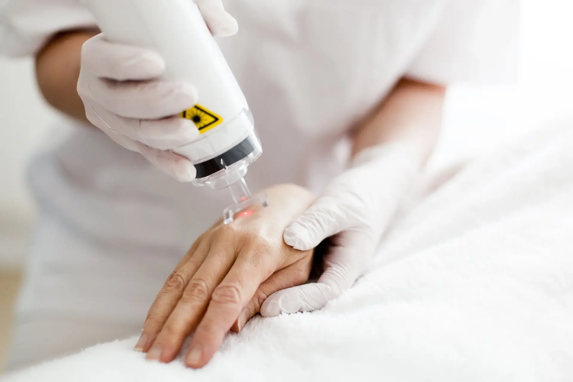 SkinTyte treatment procedure