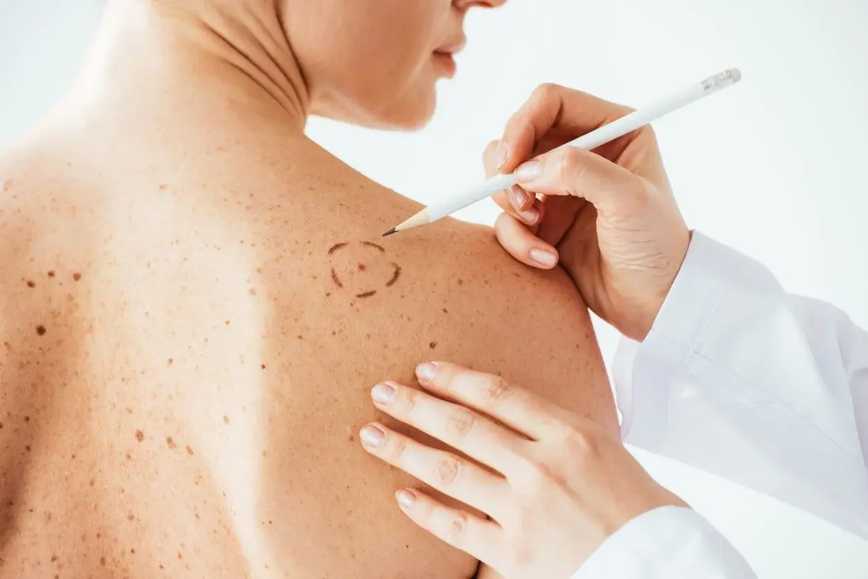 Dermatologist examining patient